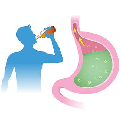 Alcohol and Leaky Gut