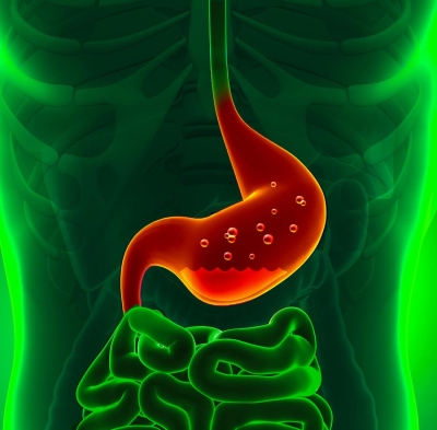 Anatomy of stomach with heartburn